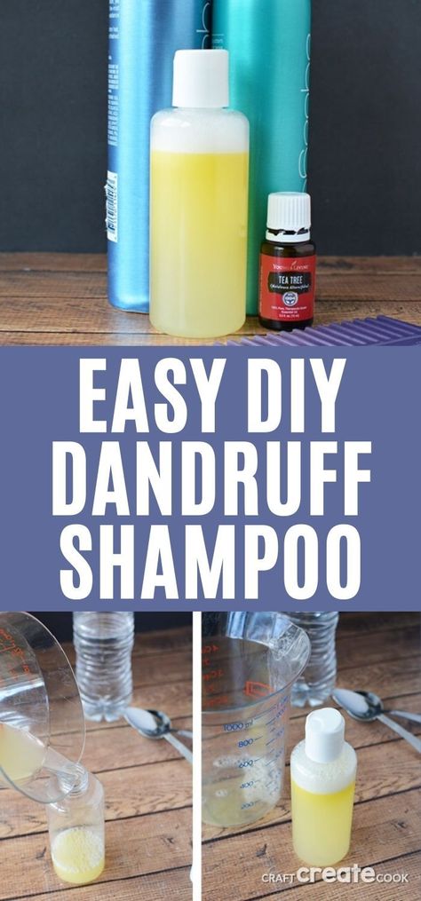 Make this easy Homemade Dandruff Shampoo with Tea Tree Oil and a few simple ingredients to add to your shower routine. A great homeopathic way to eliminate the frustration of itchy scalp! #dandruffshampoo #teatreeoil #diyshampoo #homemadeshampoo Dandruff Shampoo Diy, Homemade Shampoo For Dandruff, Diy Shampoo For Dandruff, Tea Tree Oil Shampoo Diy, Natural Dandruff Shampoo, Diy Tea Tree Shampoo, Homemade Dandruff Shampoo, Diy Dandruff Shampoo, Tea Tree Oil For Dandruff