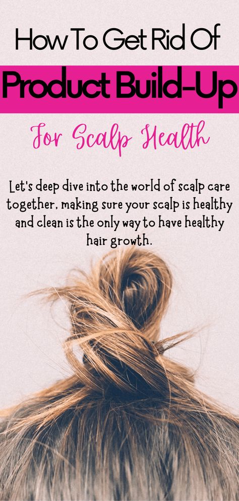 How To Get Rid Of Product Buildup On Your Scalp - Advice From Nobody Diy Scalp Detox, Smelly Scalp, Scalp Remedies, Dry Scalp Remedy, Tips For Dry Hair, Home Remedies For Dandruff, Hair Buildup, Scalp Cleanse, Clean Scalp