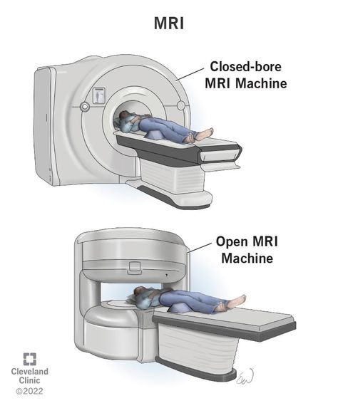 MRI (Magnetic Resonance Imaging): What It Is, Types & Results X Ray Machine, Vagus Nerve Stimulator, Mri Machine, Art Spread, Mri Technologist, Mri Tech, Pelvic Region, Radiology Technologist, Radio Waves