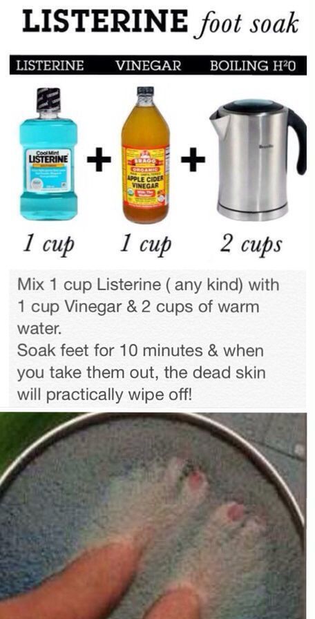 Vinegar Foot Soak, Listerine Foot Soak, Foot Soak Recipe, Foot Soak, Juice Recipes, Beauty Remedies, Skin Care Remedies, Natural Health Remedies, Beauty Skin Care Routine