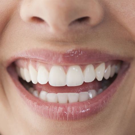 Pretty Teeth, Get Whiter Teeth, Teeth Whitening Remedies, Teeth Whitening Diy, Beautiful Teeth, Teeth Bleaching, Loose Tooth, Perfect Teeth, Smile Teeth