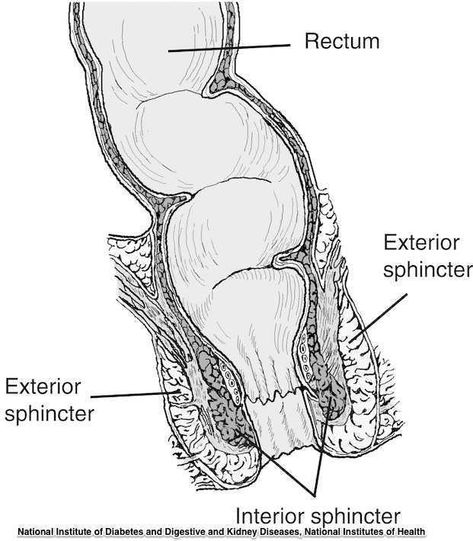 Rectal Prolapse: The Basics Intestines Anatomy, Levator Ani, Rectal Prolapse, Pelvic Floor Muscle Exercise, Sigmoid Colon, Large Bowel, Cleft Lip And Palate, Sistem Pencernaan, Cleft Palate