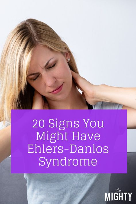 20 Signs You Might Have Ehlers-Danlos Syndrome Ehler Danlos Syndrome, Ehlers Danlos Syndrome Diet, Hyper Mobility Syndrome, Eds Symptoms, Ehlers Danlos Syndrome Hypermobility Diet, Hypermobile Ehlers Danlos Syndrome, Eds Ehlers Danlos Syndrome, Elhers Danlos Syndrome Hypermobility, Ehlers Danlos Syndrome Symptoms