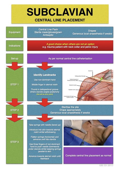 Subclavian Vein, Nclex Prep, Central Line, Medical School Studying, Nursing Study, Nclex, D P, Ultrasound, Medical School