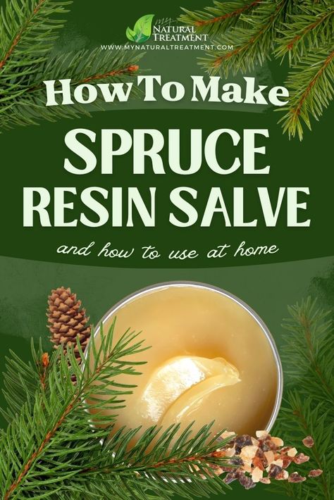 Discover the amazing spruce resin salve recipe and how to use pine resin salve for various ailments at home. Pine Resin Uses, Pine Pitch Salve, Pine Salve, Apothecary Ideas, Pine Pitch, Diy Apothecary, Medicinal Wild Plants, Spa Stuff, Spruce Tips