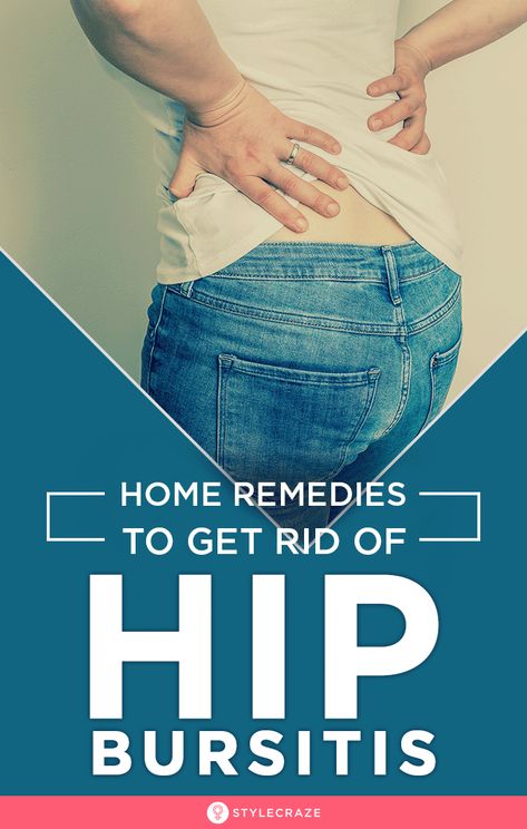 Bursitis Hip, Hip Pain Relief, Natural Headache Remedies, Back Pain Remedies, Nerve Pain Relief, Planet Fitness, Joints Pain Relief, Holistic Remedies, Hip Pain