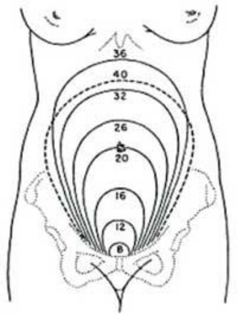 Changes in uterine size during pregnancy. I love that my uterus will remain tiny. Antepartum Nursing, Med Surge, Peds Nursing, Pregnancy Chart, Newborn Nursing, Fibroid Tumors, Ob Nursing, Nurse Stuff, Prenatal Care