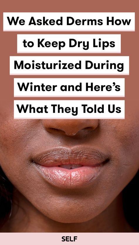 Best Lip Moisturizer, Dry Lips Remedy, Winter Lip Balm, Very Dry Lips, Lips Peeling, Dry Cracked Lips, Lip Tips, Dry Nose, Winter Lips