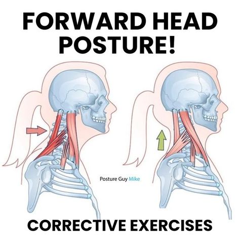 Michael Boshnack on Instagram: "⁉️ Want to improve your forward head posture?

🎯Try these three easy exercises! 

If you want a more comprehensive plan to follow,
check out my Posture App📲 Comment the words “GET STARTED” below and I’ll DM you an exclusive offer for 40% off my forward head posture program!

🤔 Not sure if you have forward head posture?
Comment the words “POSTURE TEST” below and I’ll DM you a FREE at home Posture test, so you can find out!

⬇️ Here is some background info on forward head posture!

🚶Forward head posture is a common condition where the head protrudes forward, out of alignment with the spine. 

😬 This misalignment often results from prolonged screen time, poor ergonomics, a lack of physical activity, and muscle imbalances. 

✅ By incorporating these exercis Forward Head Posture Exercises, Physical Therapy Student, Neck And Shoulder Muscles, Forward Head Posture, Muscle Imbalance, Posture Exercises, Easy Exercises, Bad Posture, Sitting Position