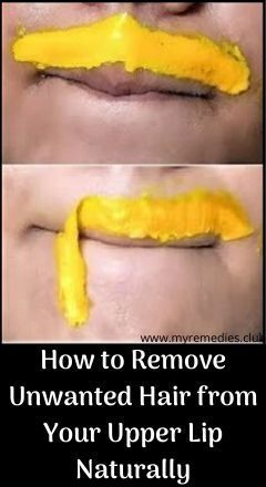 How to Remove Unwanted Hair from Your Upper Lip Naturally... how to stop hair growth on upper lip naturally upper lip hair removal at home naturally permanently how to remove upper lip hair at home immediately how to remove mustache for girl naturally and permanently best upper lip hair removal method how to remove upper lip hair in 5 minutes .... Unwanted Facial Hair Removal, Chin Hair Removal, Permanent Facial Hair Removal, Upper Lip Hair Removal, Back Hair Removal, Female Facial Hair, Best Facial Hair Removal, Electrolysis Hair Removal, Lip Hair Removal