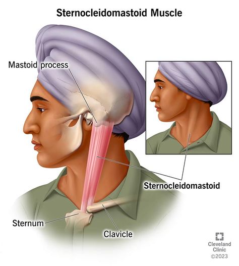 Scm Muscle, Sternocleidomastoid Muscle, Referred Pain, Neck Tattoo For Guys, Skeletal Muscle, Good Posture, Cold Therapy, Neck Tattoo, Blood Vessels