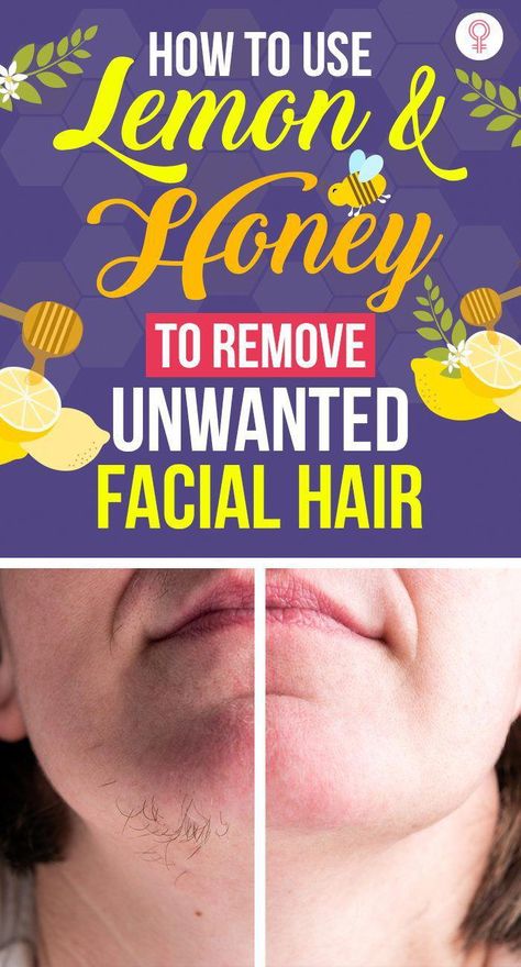 Are you suffering from unwanted facial hair? Then, your wait is over. Click here to learn how to get rid of facial hair with simple and effective home remedies. Natural Hair Remover For Face, Diy Liquid Soap, Homemade Hair Removal, Natural Facial Hair Removal, Facial Hair Removal For Women, Hair Sticking, To Remove Facial Hair, Lemon And Honey, Face Hair Removal