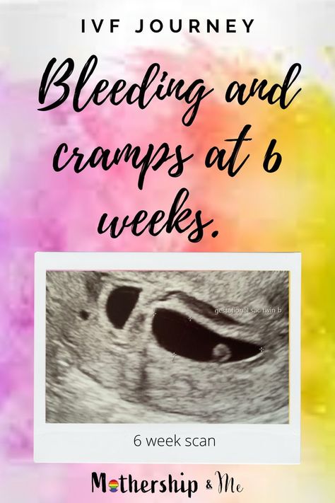 bleeding blood clot and cramps at 6 weeks pregnant. our ivf journey. Five Weeks Pregnant, Seven Weeks Pregnant, 7 Weeks Pregnant, 6 Weeks Pregnant, Ivf Tips, 5 Weeks Pregnant, Hcg Levels, Vegan Pregnancy, Ivf Pregnancy