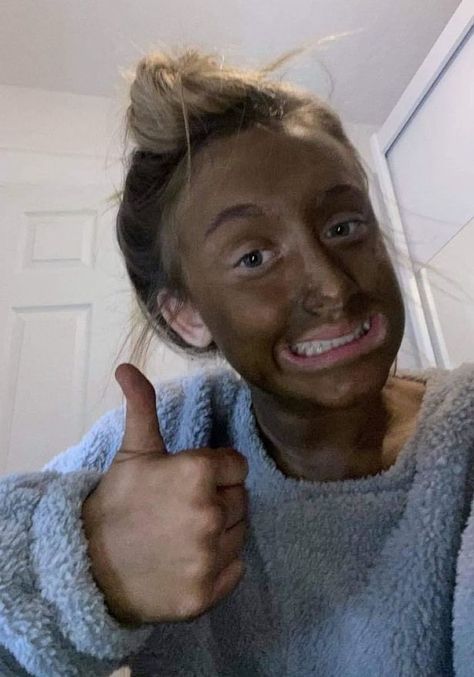 Dark Fake Tan, Fake Tan Freckles, Fake Tan Aesthetic, Diy Tanning Lotion, Tan Contour, Natural Fake Tan, Best Fake Tan, Tan Fail, Diy Tanning