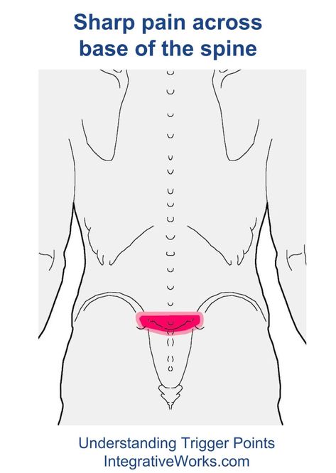 Trigger Points – Sharp pain in the center of the low back when rising | | Integrative Works Back Spasm Relief, Severe Lower Back Pain, Forward Head Posture Exercises, Back Spasm, Neck And Shoulder Muscles, Pain Relief Remedies, Forward Head Posture, Frozen Shoulder, Back Pain Remedies