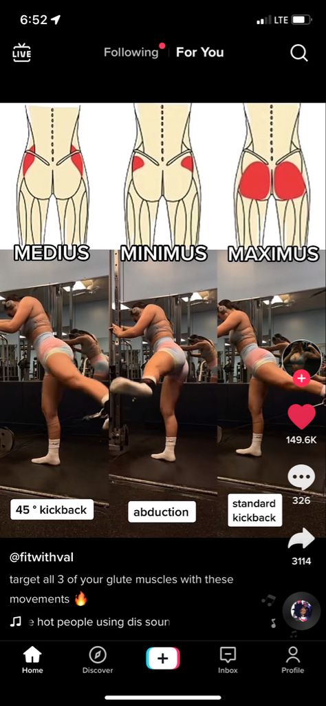 Workouts For Glute Medius, Gluteus Exercises Gym, Workout For Gluteus Medius, Workout Upper Glutes, Glute Maximus Workout Target, Exercises For Gluteus Maximus, Gluteus Muscles Anatomy, Kickback Workout Exercise, Glutes Anatomy Muscle