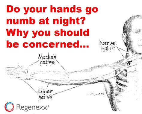 Tingly Numb Hands, Numbness In Fingers, Numb Hands, Tingling Hands, Arm Numbness, Numbness In Hands, Carpel Tunnel, Hand Health, Pinched Nerve