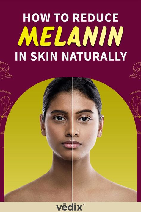 How To Reduce Melanin In Skin Naturally Melanin Reducing Tips, How To Decrease Melanin In Skin, How To Reduce Melanin In Skin Naturally, How To Brighten Skin Naturally, How To Reduce Melanin In Skin, How To Brighten Skin, Even Skin Tone Naturally, Dull Skin Remedies, Remedies For Hyperpigmentation