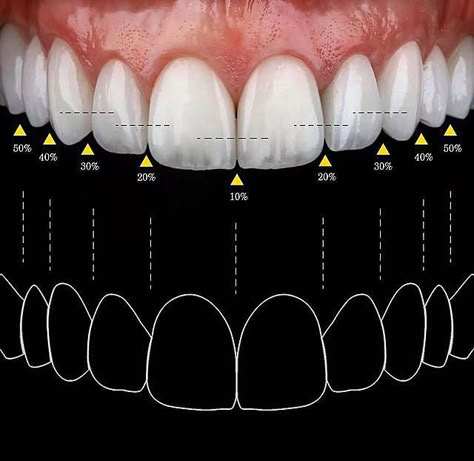 Dental Lab Technician, Dental Ceramics, Dental Pictures, Teeth Aesthetic, Dental Advertising, Dental Photos, Dental Posters, Dental Aesthetics, Dental Videos