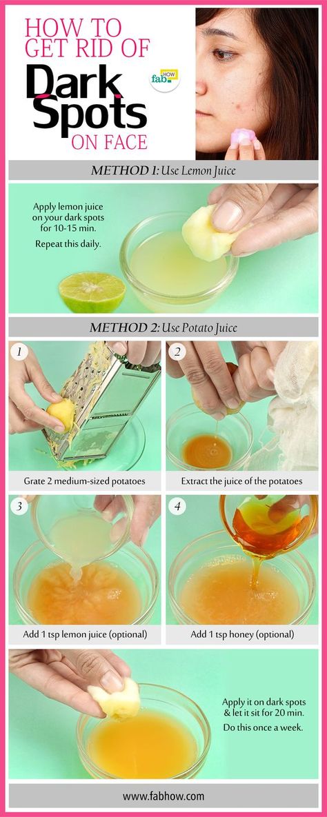 Sun Spots On Skin, Black Spots On Face, Sunspots On Face, Brown Spots On Hands, Brown Age Spots, Potato Juice, Brown Spots On Skin, Dark Spots On Face, Brown Spots Removal