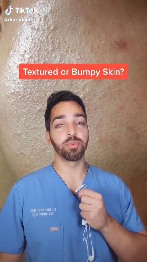 Treat Oily Skin, Tips Tiktok, Selfcare Tips, Haut Routine, Textured Skin, Skincare For Oily Skin, Clear Healthy Skin, Losing 40 Pounds, Bumpy Skin