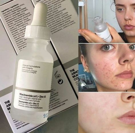 Glowing Skin By Catherine Ordinary Niacinamide, Skin Care Basics, Vitamin And Mineral, Face Skin Care Routine, Congested Skin, Face Acne, Facial Skin Care Routine, روتين العناية بالبشرة, Moisturizing Serum