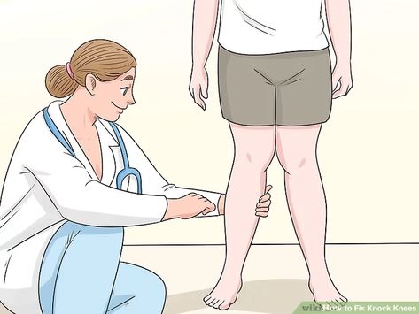 3 Ways to Fix Knock Knees - wikiHow Fallen Arches Exercises, Fix Knock Knees, Knock Knees Exercises, Genu Valgum, Knock Knees, Fallen Arches, Beautiful Skin Care, Simple Lifestyle, Knee Exercises