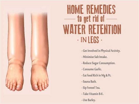 Water Retention Remedies, Inflammation Recipes, Reduce Thigh Fat, Colon Cleansing, Exercise To Reduce Thighs, Lose Thigh Fat, Lower Back Pain Exercises, Natural Colon Cleanse, Anti Inflammation