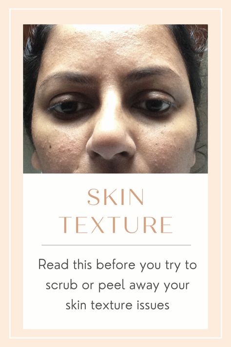 Bumpy Skin Texture On Face, How To Even Out Skin Texture, Skin Care For Dry Textured Skin, Bumpy Face Remedy, What Helps Textured Skin, Best Products For Skin Texture, How To Fix Bumpy Skin, Textured Face Remedies, How To Smooth Textured Skin