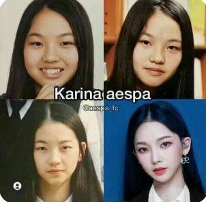 Aespa Predebut, Kpop Plastic Surgery, Model Makeup Tutorial, Face Transformation, Korean Plastic Surgery, Celebrity Plastic Surgery, Eye Surgery, Models Makeup, Cosmetic Procedures