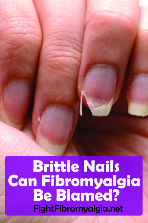 Brittle Nails: Can Fibromyalgia Be Blamed? - #blamed #brittle #fibromyalgia #nails #BiotinForHairLoss #HowToPreventBabyHairLoss #BiotinAndHairLoss #NaturalRemediesForHairLoss #BlackCoffeeForWeightLoss Hands Care, Nail Conditions, Essential Oils For Hair, Brittle Nails, Chronic Fatigue, Homemade Dog, Hand Care, Health Conditions, Migraine