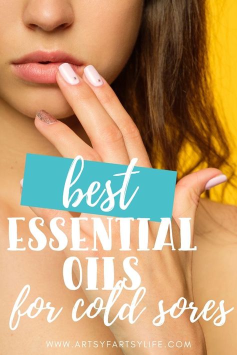 How To Use Essential Oils For Cold Sores Essential Oil For Fever Blister On Lip, Doterra Cold Sore Remedy, Home Remedy For Fever Blister, Essential Oils For Cold Sores On Lip, Essential Oils For Fever Blister, Essential Oil For Cold Sore, Home Remedy For Cold Sore On Lip, Essential Oil For Cold Sore On Lip, Fever Blister Essential Oils