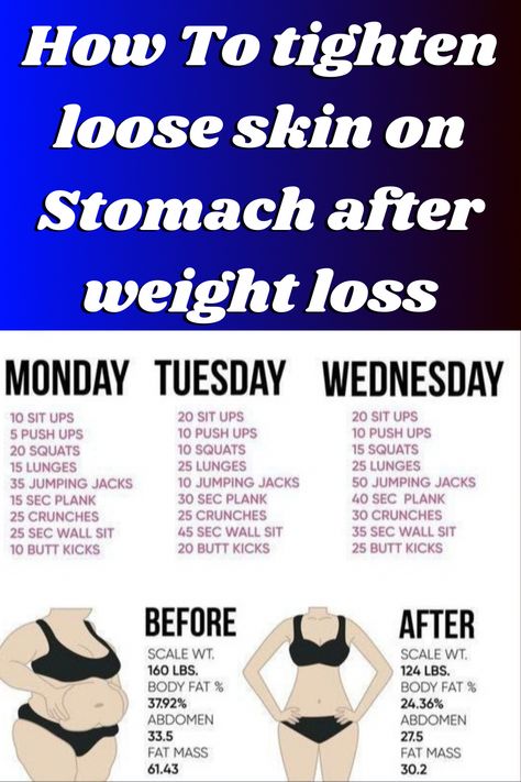 Workout To Tighten Loose Belly Skin, Workout For Loose Skin, Exercises For Loose Skin, Workouts To Tighten Loose Skin, Sagging Stomach Exercise, Skin Tightening Workout, Tone Loose Belly Skin, Exercise For Loose Belly Skin, Tighten Skin On Stomach