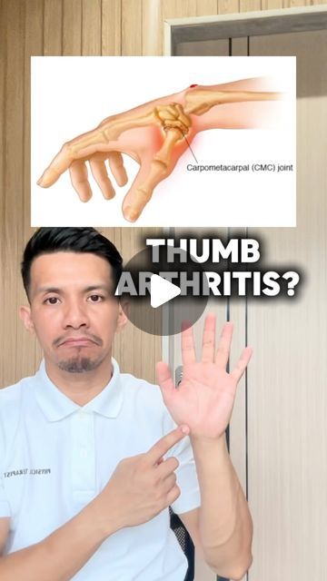 Madz Mariwa 🇵🇭 on Instagram: "THUMB ARTHRITIS EXERCISES! FAST RELIEF 🤩🤩🤩 

#viral #arthritis #arthritisrelief #exercise" Hand Weight Exercises, Tens Electrode Placement, Thumb Exercises, Thumb Pain Relief, Hand Therapy Exercises, Carpal Tunnel Exercises, Flexibility Stretches, Target Workout, Head Shoulders Knees And Toes