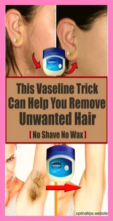 This Vaseline Trick Can Help You Remove Unwanted Hair Back Hair Removal, Leg Hair Removal, Electrolysis Hair Removal, Hair Remove, Ingrown Hair Removal, Unwanted Hair Permanently, Underarm Hair Removal, Remove Unwanted Hair, Permanent Hair Removal