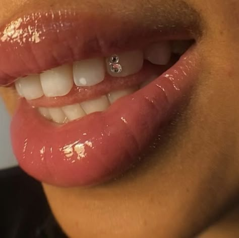 Tooth Gem Ideas, Teeth Gems, Pretty Teeth, Dental Jewelry, Grillz Teeth, Studera Motivation, Diamond Teeth, Grills Teeth, Tooth Gems