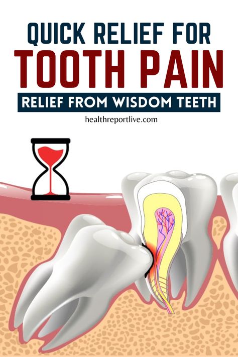 Quick Relief for Tooth Pain Relief From Wisdom Teeth How To Help A Tooth Ache, Tooth Ache Relief Remedies Diy, Cloves For Tooth Pain, Home Remedies For Tooth Pain, Natural Tooth Pain Relief, Tooth Ache Relief Fast, Tooth Pain Relief Severe, Wisdom Tooth Pain Relief, Wisdom Teeth Swelling