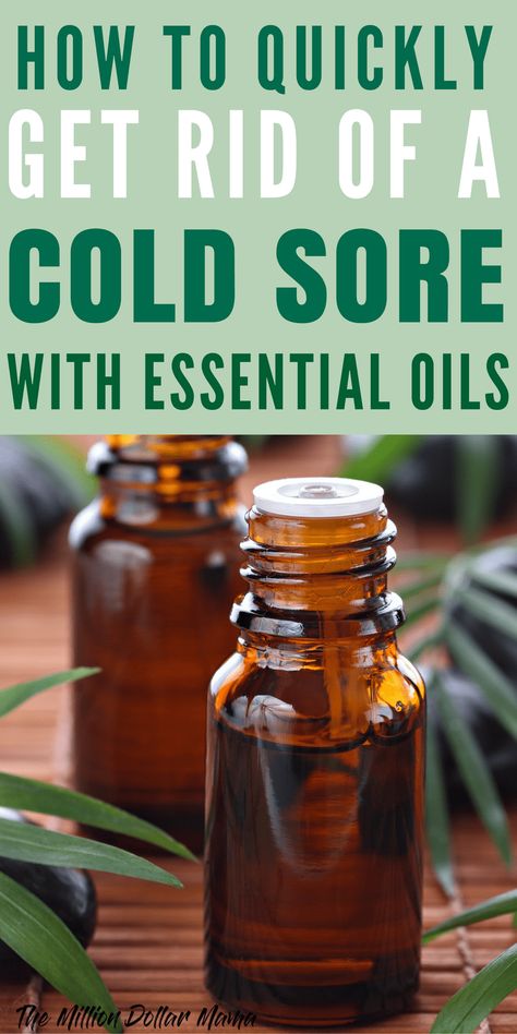 Natural Cold Sore Remedy That Really Works - How to Quickly Get Rid of a Cold Sore With Essential Oils Cold Sore Remedy, Natural Cold Sore Remedy, Oils For Colds, Natural Remedies For Cough, Cold Sore Remedies, Essential Oils For Colds, For Sore Throat, Medicine Tips, Remedies For Cough