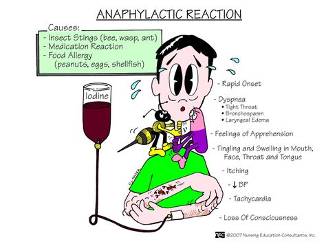 Anaphylactic Reaction. http://nurseslabs.com/medical-surgical-nursing-mnemonics-tips-1/ Nursing Information, Med Surg Nursing, Nursing Mnemonics, Anaphylactic Shock, Surgical Nursing, Medical Surgical Nursing, Nursing School Survival, Nurse Rock, Nursing School Studying