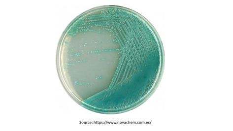 Pseudomonas Aeruginosa, Bunsen Burner, Magnesium Chloride, Body Fluid, Black Pigment, Microbiology, Lab, Composition, Quick Saves