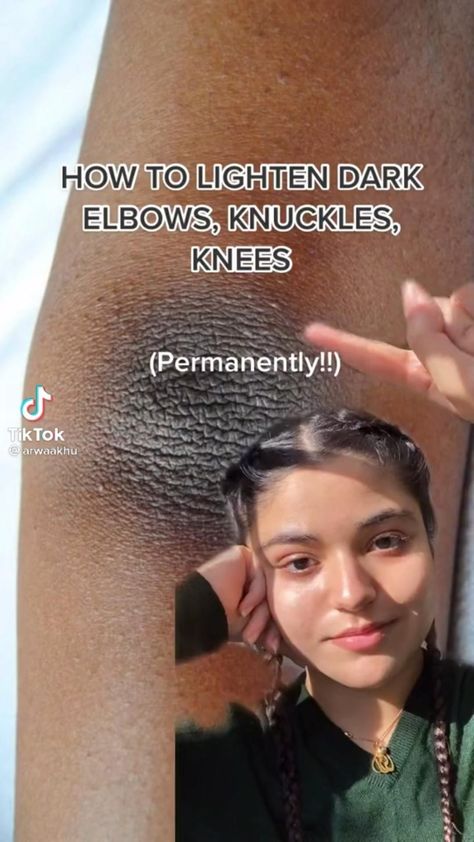 Dark Knees, Premature Wrinkles, Beginner Skin Care Routine, Skin Care Basics, Skin Advice, Skin Care Routine Order, Basic Skin Care, Diy Skin Care Routine, Serious Skin Care