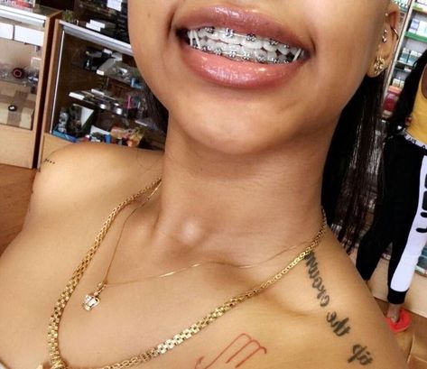 Follow: T I N Y Y for more Silver Braces, Braces Ideas, Braces Smile, Natural Teeth Whitening Diy, Black Braces, Cute Braces Colors, Girls With Braces, Pretty Teeth