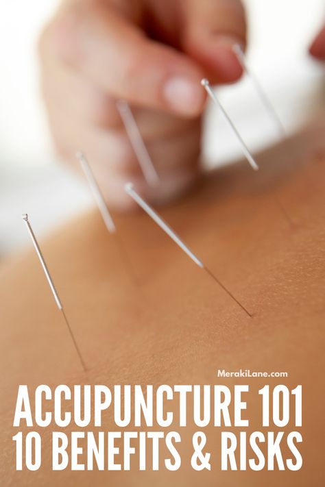 10 Health Benefits of Acupuncture for Your Mind and Body | What is acupuncture? What conditions is it used to treat, how does it work, what are the benefits, and are there any risks? Acupuncture points are thought to stimulate the central nervous system, stimulating the body's natural healing abilities and helping with chronic pain, stress, and even fertility. If you're new to this form of alternative medicine -- a component of traditional Chinese medicine -- this post has all the details! Acupuncture Benefits, Acupressure Mat, Scrub Corpo, Integrative Health, Acupuncture Points, Massage Techniques, Physical Wellness, Alternative Health, Traditional Chinese Medicine