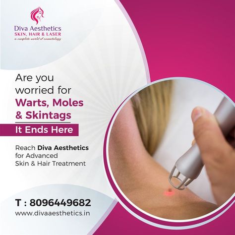 If you're worried about warts, moles or skintags, reach out to Diva Aesthetics' for a solution. We specialize in wart, mole and skintag removal and can help you get rid of these unsightly blemishes quickly and easily. We look forward to helping you achieve the clear skin you've always wanted! We bring all the answers you need to know! Book your Appointment call us: 8096449682 #Diva #divaaesthetic #aesthetics #miyapur #warts #moles #skintags #laser Warts Removal, Skin Clinic, Book Your Appointment, Laser Hair, Cosmetology, Mole, Clear Skin, Diva, Need To Know