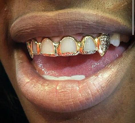 Gold Teeth Grills, Gold Teeth Grillz, Fang Grillz, Teeth Gems, Dental Jewelry, Grillz Teeth, Diamond Grillz, Gold Grill, Custom Grillz