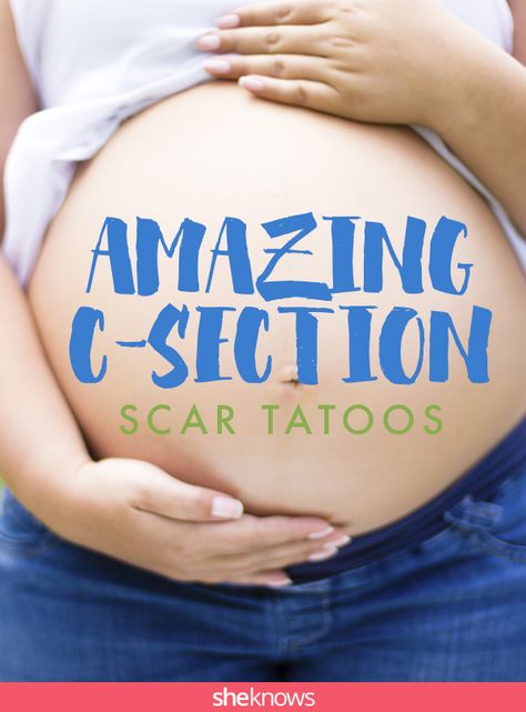 You will never believe what these moms did with their C-section scars Tattoo To Cover C Section, C Section Tatoos, Tattoo For C Section Scar, Feminine Marine Corps Tattoo, C Section Tattoos For Women, Neck Scar Tattoo Cover, Abdomen Scar Tattoo Cover Up, Cesarean Tattoo Cover Up, Tattoo Over C Section Scar