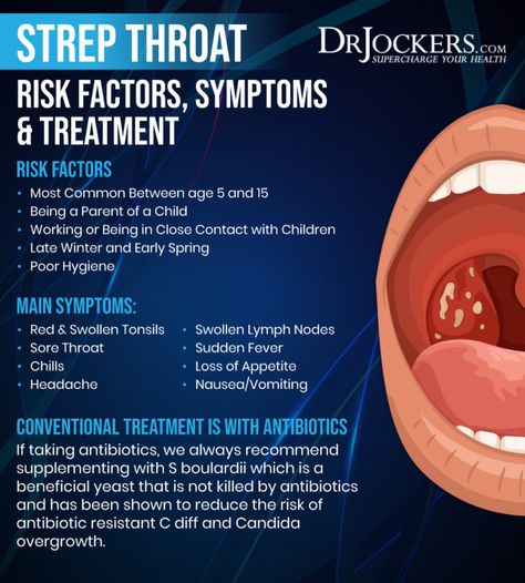 Tickle In Throat Remedy How To Get Rid, Foods To Eat With Strep Throat, How Long Is Strep Throat Contagious, Natural Throat Soother, Treating Strep Throat Naturally, How To Prevent Strep Throat, Treat Strep Throat Naturally, Herbs For Strep Throat, Tea For Strep Throat