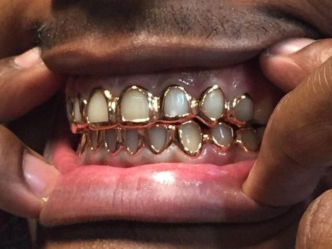 Open Face Grillz, Girl Grillz, Grillz Teeth, Gold Grill, Diamond Teeth, Gold Grillz, Grills Teeth, The Teeth, Tooth Gem