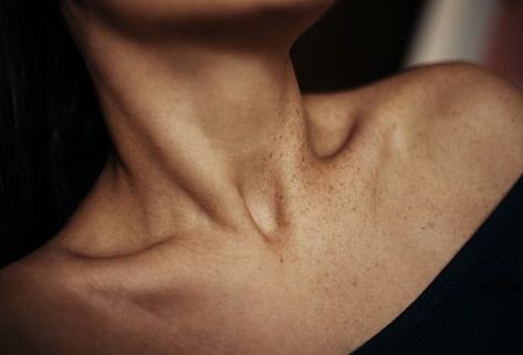 Clavicle (collarbone) pain: Causes, home remedies, and prevention tips Sun In Capricorn, Tech Neck, Tissue Types, Pectoral Muscles, Neck Bones, Body Aesthetic, Body Photography, Collar Bone, Sensitive Skin Care