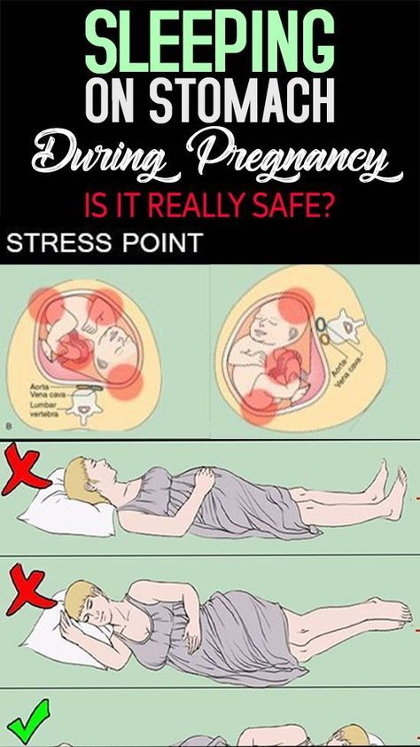 Sleeping positions while pregnant Pregnancy Info, How To Sleep, Pregnancy Information, Pumping Moms, Baby Sleep Problems, Mom Junction, Pregnancy Safe Products, Pregnancy Care, Winter Hair